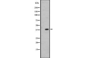 Western blot analysis of OR7E24 expression in 721_B whole cell lysate ,The lane on the left is treated with the antigen-specific peptide. (OR7E24 antibody)