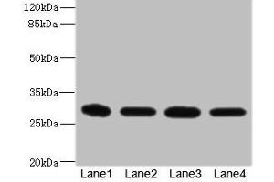 Western blot All lanes: EIF3K antibody at 1. (EIF3K antibody  (AA 1-218))