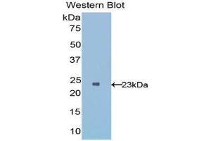 Western Blotting (WB) image for anti-Interleukin 1 Receptor-Like 1 (IL1RL1) (AA 162-349) antibody (ABIN1176679) (IL1RL1 antibody  (AA 162-349))