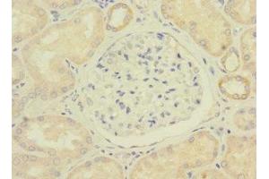 Immunohistochemistry of paraffin-embedded human kidney tissue using ABIN7175065 at dilution of 1:100 (C11orf1 antibody  (AA 33-150))