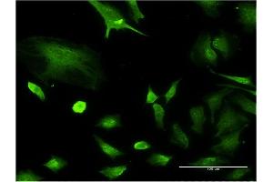 Immunofluorescence of monoclonal antibody to NPM1 on HeLa cell. (NPM1 antibody  (AA 1-294))