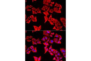 Immunofluorescence analysis of U20S cell using THRSP antibody. (THRSP antibody)
