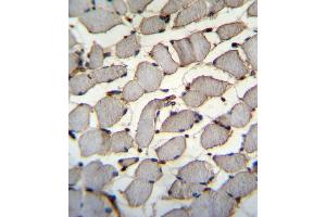 DDX60L Antibody (C-term) (ABIN655540 and ABIN2845051) immunohistochemistry analysis in formalin fixed and paraffin embedded human skeletal muscle followed by peroxidase conjugation of the secondary antibody and DAB staining. (DDX60L antibody  (C-Term))