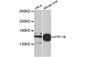 Western blot analysis of extracts of various cell lines, using ATP11B antibody (ABIN5997278) at 1/1000 dilution. (ATP11B antibody)