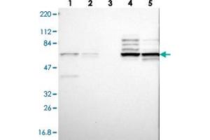 Western blot analysis of Lane 1: RT-4, Lane 2: U-251 MG, Lane 3: Human Plasma, Lane 4: Liver, Lane 5: Tonsil with CNOT4 polyclonal antibody .
