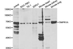 Western blot analysis of extracts of various cell lines, using BMPR1A antibody.