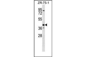 Western blot analysis of KCNK1 Antibody (C-term) in ZR-75-1 cell line lysates (35ug/lane). (KCNK1 antibody  (C-Term))