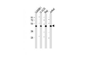 All lanes : Anti-ETV6 Antibody (N-term) at 1:2000 dilution Lane 1: U266B1 whole cell lysate Lane 2: U-2OS whole cell lysate Lane 3: Raji whole cell lysate Lane 4: Jurkat whole cell lysate Lysates/proteins at 20 μg per lane. (ETV6 antibody  (N-Term))