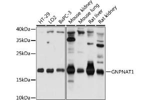 Western blot analysis of extracts of various cell lines, using GNPN antibody (ABIN7267399) at 1:1000 dilution. (GNPNAT1 antibody  (AA 1-91))