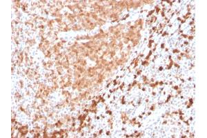 Formalin-fixed, paraffin-embedded human Tonsil stained with TCL1 Recombinant Rabbit Monoclonal Antibody (TCL1/2747R). (Recombinant TCL1A antibody  (AA 2-109))