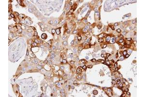 IHC-P Image Immunohistochemical analysis of paraffin-embedded H441 xenograft, using PDE4D, antibody at 1:100 dilution. (PDE4D antibody  (C-Term))