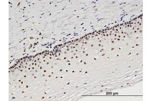 Immunoperoxidase of monoclonal antibody to STRADA on formalin-fixed paraffin-embedded human uterine cervix. (STRADA antibody  (AA 251-346))