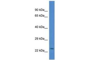 Image no. 1 for anti-Cysteine and Glycine-Rich Protein 2 (CSRP2) (AA 90-139) antibody (ABIN6746083) (CSRP2 antibody  (AA 90-139))