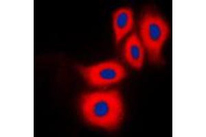 Immunofluorescent analysis of eNOS (pS1177) staining in HuvEc cells. (ENOS antibody  (C-Term, pSer1177))