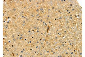 ABIN6265196 and ABIN6277869 at 1/100 staining Rat brain tissue by IHC-P.