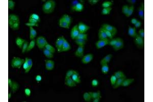 Immunofluorescence staining of HepG2 cells with ABIN7164001 at 1:100, counter-stained with DAPI. (KCNQ3 antibody  (AA 763-872))