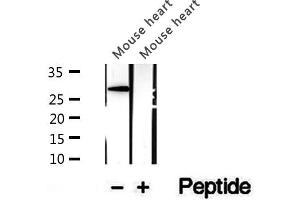 Western blot analysis of extracts of mouse heart tissue, using CHMP4B antibody.