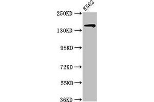 Western Blot Positive WB detected in: K562 whole cell lysate All lanes: SIN3A antibody at 2 μg/mL Secondary Goat polyclonal to rabbit IgG at 1/50000 dilution Predicted band size: 146 kDa Observed band size: 146 kDa (SIN3A antibody  (AA 1-123))