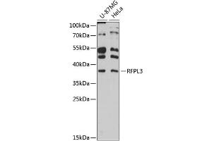 Western blot analysis of extracts of various cell lines, using RFPL3 antibody (ABIN6130677, ABIN6146893, ABIN6146894 and ABIN6215966) at 1:3000 dilution. (RFPL3 antibody  (AA 1-288))
