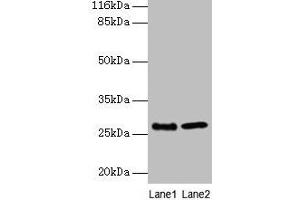 Western blot All lanes: EBP antibody at 2 μg/mL Lane 1: A549 whole cell lysate Lane 2: 293T whole cell lysate Secondary Goat polyclonal to rabbit IgG at 1/10000 dilution Predicted band size: 27 kDa Observed band size: 27 kDa