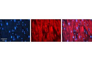 Rabbit Anti-CDC34 Antibody  AV Formalin Fixed Paraffin Embedded Tissue: Human heart Tissue Observed Staining: Cytoplasmic near intercalated discs Primary Antibody Concentration: 1:100 Other Working Concentrations: N/A Secondary Antibody: Donkey anti-Rabbit-Cy3 Secondary Antibody Concentration: 1:200 Magnification: 20X Exposure Time: 0. (CDC34 antibody  (Middle Region))