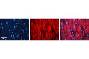 Rabbit Anti-CDC34 Antibody  AV Formalin Fixed Paraffin Embedded Tissue: Human heart Tissue Observed Staining: Cytoplasmic near intercalated discs Primary Antibody Concentration: 1:100 Other Working Concentrations: N/A Secondary Antibody: Donkey anti-Rabbit-Cy3 Secondary Antibody Concentration: 1:200 Magnification: 20X Exposure Time: 0.