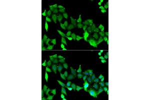 Immunofluorescence analysis of A549 cell using GRK6 antibody. (GRK6 antibody)
