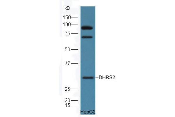 DHRS2 Antikörper  (AA 61-160)