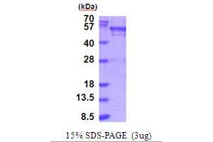 SDS-PAGE (SDS) image for Bromodomain Containing 3 (BRD3) (AA 1-416) protein (His tag) (ABIN5854008)