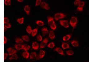 ABIN6266601 staining K562 by IF/ICC.