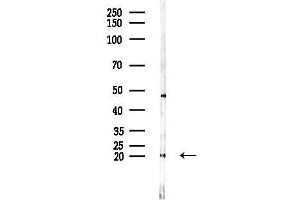anti-Intraflagellar Transport 20 Homolog (IFT20) antibody