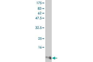 Western Blot detection against Immunogen (12. (IL-15 antibody  (AA 49-162))