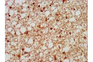 IHC image of ABIN7153781 diluted at 1:100 and staining in paraffin-embedded human brain tissue performed on a Leica BondTM system. (GTF3C5 antibody  (AA 305-448))