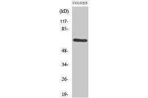 Western Blotting (WB) image for anti-G Protein-Coupled Receptor Kinase 1 (GRK1) (Thr8) antibody (ABIN3184939) (GRK1 antibody  (Thr8))