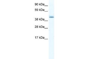 DDX49 antibody used at 2. (DDX49 antibody)