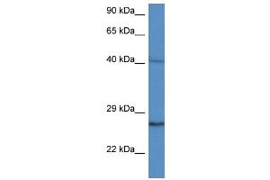 WB Suggested Anti-CCS AntibodyTitration: 1. (Superoxide dismutase copper chaperone antibody  (C-Term))