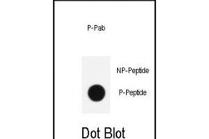 Dot blot analysis of anti-Phospho-KLF4- Antibody (ABIN390035 and ABIN2839785) on nitrocellulose membrane. (KLF4 antibody  (pSer254))