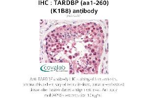 Image no. 2 for anti-TAR DNA Binding Protein (TARDBP) (AA 1-260) antibody (ABIN1723216) (TARDBP antibody  (AA 1-260))