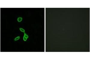 Immunofluorescence analysis of LOVO cells, using GALR1 Antibody.