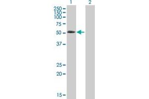 Western Blot analysis of ABLIM3 expression in transfected 293T cell line by ABLIM3 MaxPab polyclonal antibody. (ABLIM3 antibody  (AA 1-544))