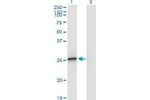 Western Blot analysis of AMELX expression in transfected 293T cell line by AMELX monoclonal antibody (M02A), clone 5B2.