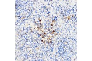 Immunohistochemistry (IHC) image for anti-Chitinase 3-Like 1 (Cartilage Glycoprotein-39) (CHI3L1) (AA 22-240) antibody (ABIN3022445)