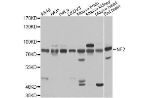 Western blot analysis of extracts of various cell lines, using NF2 antibody. (Merlin antibody)