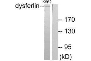 Western blot analysis of extracts from K562 cells, using Dysferlin antibody. (Dysferlin antibody)