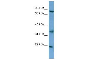 WB Suggested Anti-ABCD2 Antibody Titration: 0. (CCL17 antibody  (N-Term))