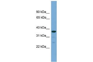 WB Suggested Anti-HAPLN2 Antibody Titration: 0. (HAPLN2 antibody  (Middle Region))