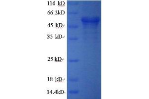 SDS-PAGE (SDS) image for Calreticulin (CALR) (AA 18-416) protein (GST tag) (ABIN5709181)
