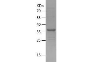 UBE2D1 Protein (AA 1-147) (His-IF2DI Tag)