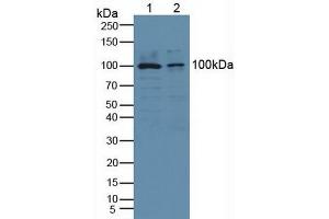 Western blot analysis of (1) Human HeLa cells and (2) Human PC-3 Cells. (PLA2G4A antibody  (AA 563-749))