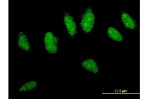 Immunofluorescence of monoclonal antibody to CYLD on HeLa cell.